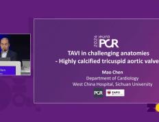 【168直播】EuroPCR 2024｜陈茂教授：高度钙化的三叶式主动脉瓣狭窄患者行TAVI面临的挑战